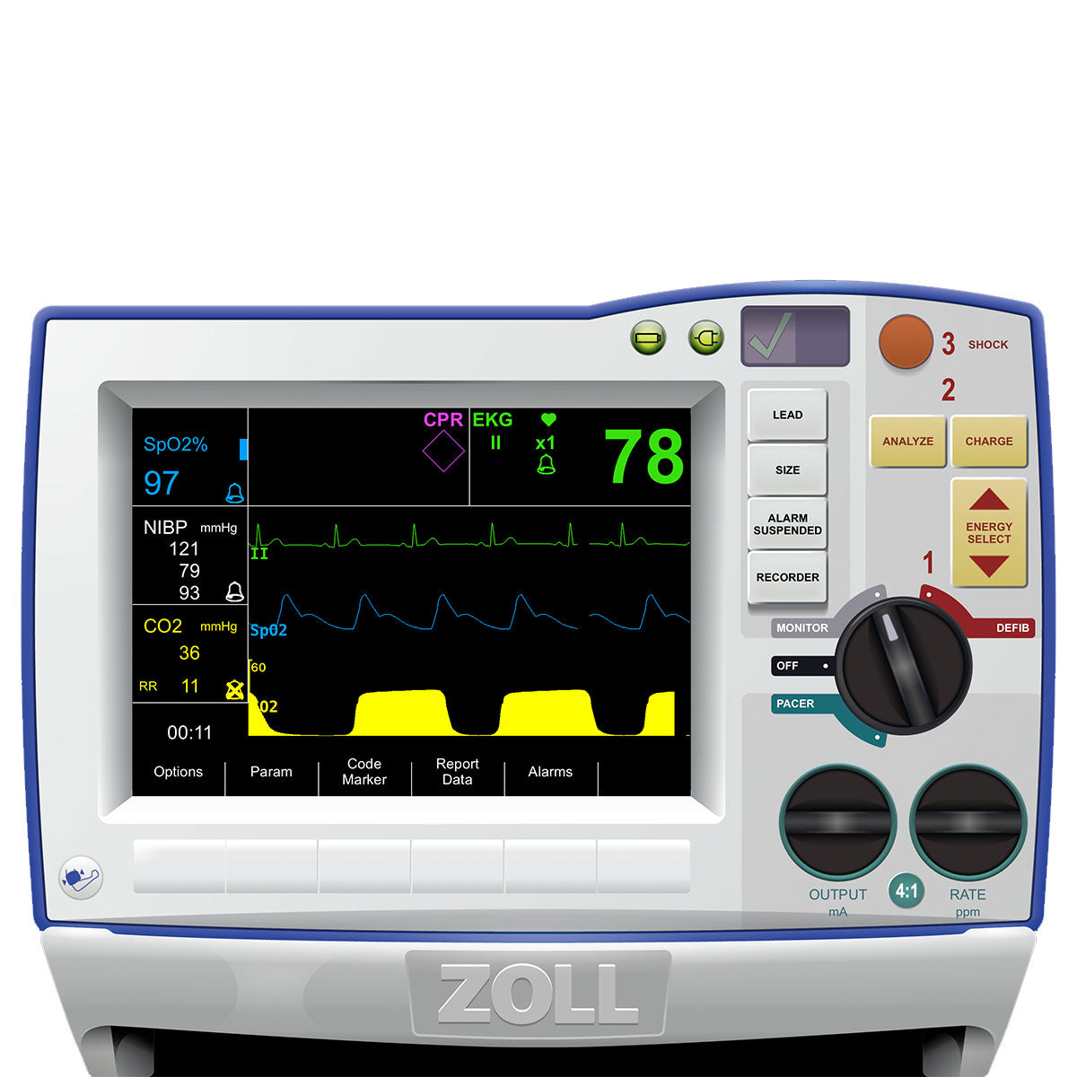 The ZOLL R Series Defibrillator/Monitor by Zoll seamlessly integrates a medical monitor with vital signs, EKG, and settings display for comprehensive patient monitoring.
