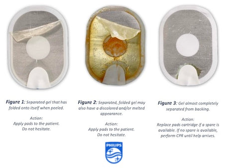 URGENT - Medical Device Recall on Philips OnSite AED SMART pads cartridges