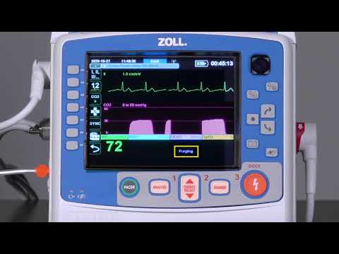 The ZOLL X Series Defibrillator Encore Series (Recertified), by Zoll, showcases vital signs and a heart rate of 72 through vivid graphs. It features clearly visible control buttons and offers open 12-lead capabilities for thorough analysis.