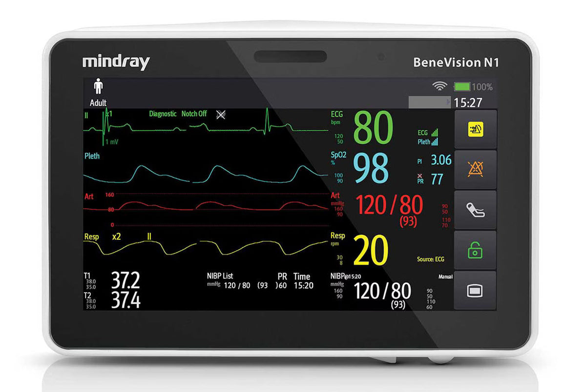 Mindray BeneVision N1 portable patient monitor displaying vital signs, heart rate, and waveforms on a digital screen.